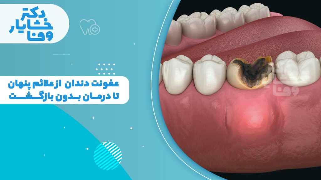 عفونت دندان و سیاه شدن دندان