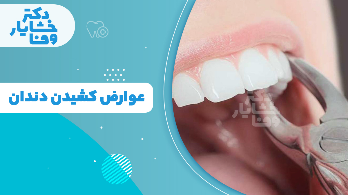 عوارض کشیدن دندان و نکات مهم پس از جراحی دندان - دکتر خشایار وفا