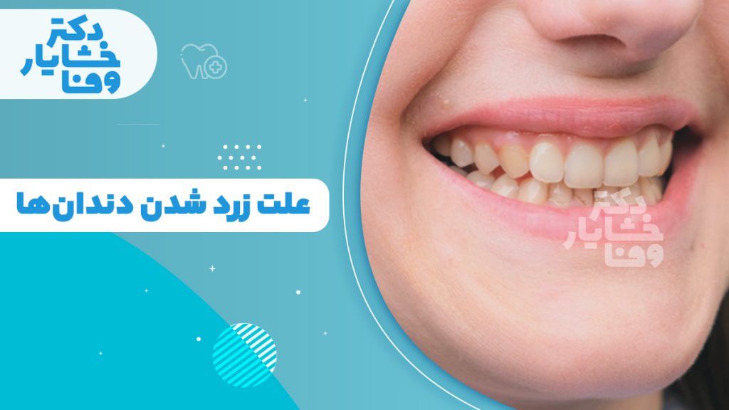 علت زرد شدن دندان‌ها و عوامل ایجاد زردی دندان