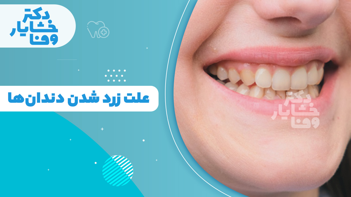 علت زرد شدن دندان‌ها و عوامل ایجاد زردی دندان