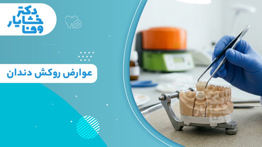 عوارض روکش دندان و مراحل ساخت پروتز دندانی دکتر خشایار وفا
