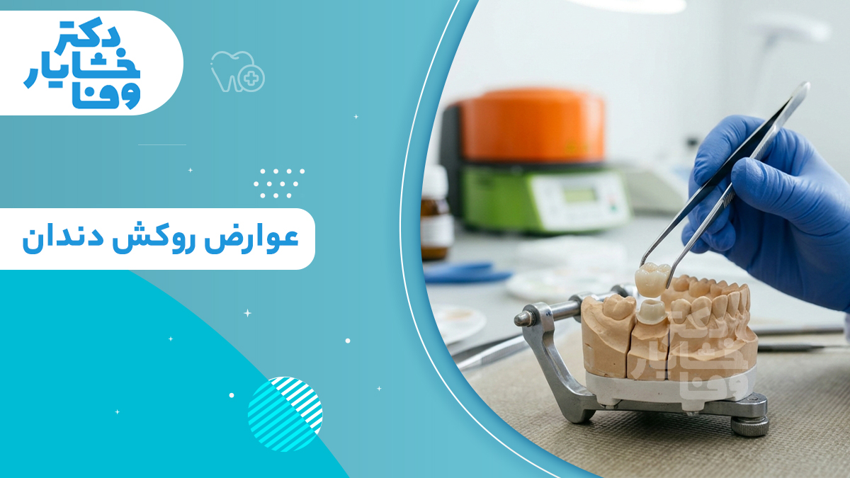 عوارض روکش دندان و مراحل ساخت پروتز دندانی دکتر خشایار وفا