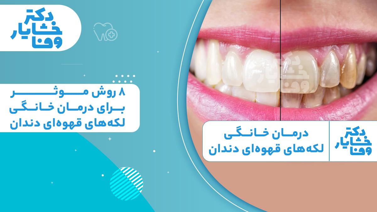مقایسه دندان‌های زرد و لکه‌دار با دندان‌های سفید شده و عنوان روش‌های درمان خانگی لکه‌های قهوه‌ای دندان دکتر خشایار وفا