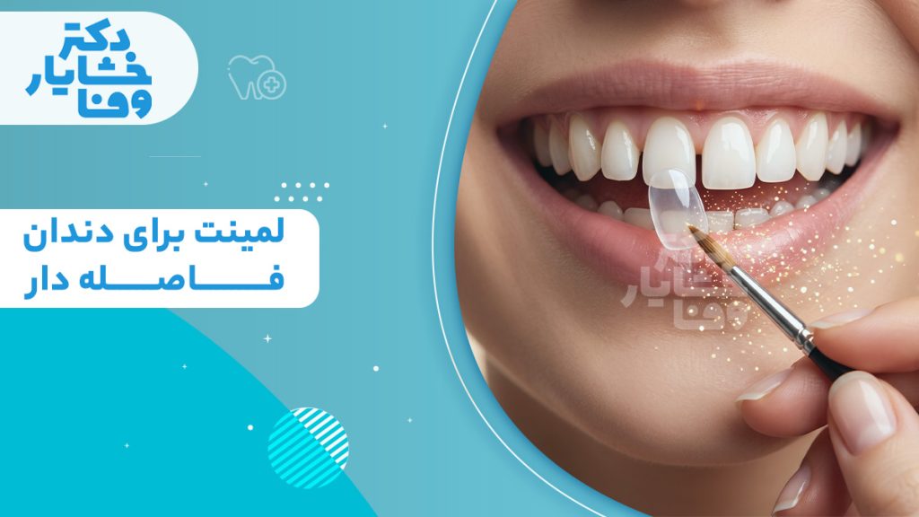 خدمات لمینت برای دندان‌های فاصله‌دار با تصویر لبخند زیبا و نصب لمینت